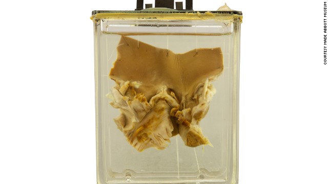 10 viện bảo t&agrave;ng y học kỳ dị nhất tr&ecirc;n thế giới